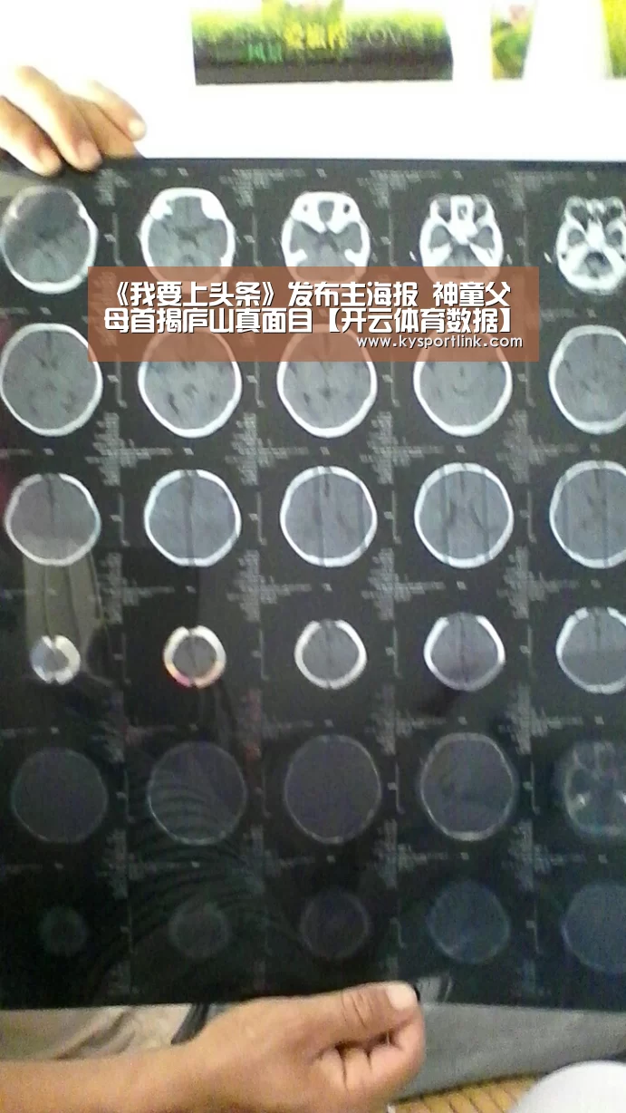 《我要上头条》发布主海报 神童父母首揭庐山真面目【开云体育数据】(图2) 开云体育数据中心